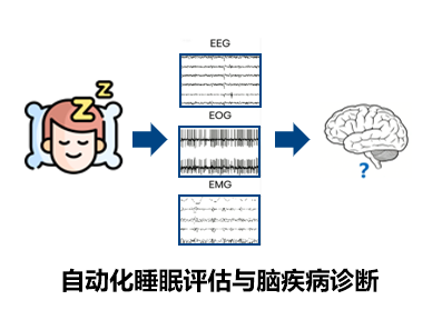 研究方向4 神经退行性疾病：早期鉴别诊断